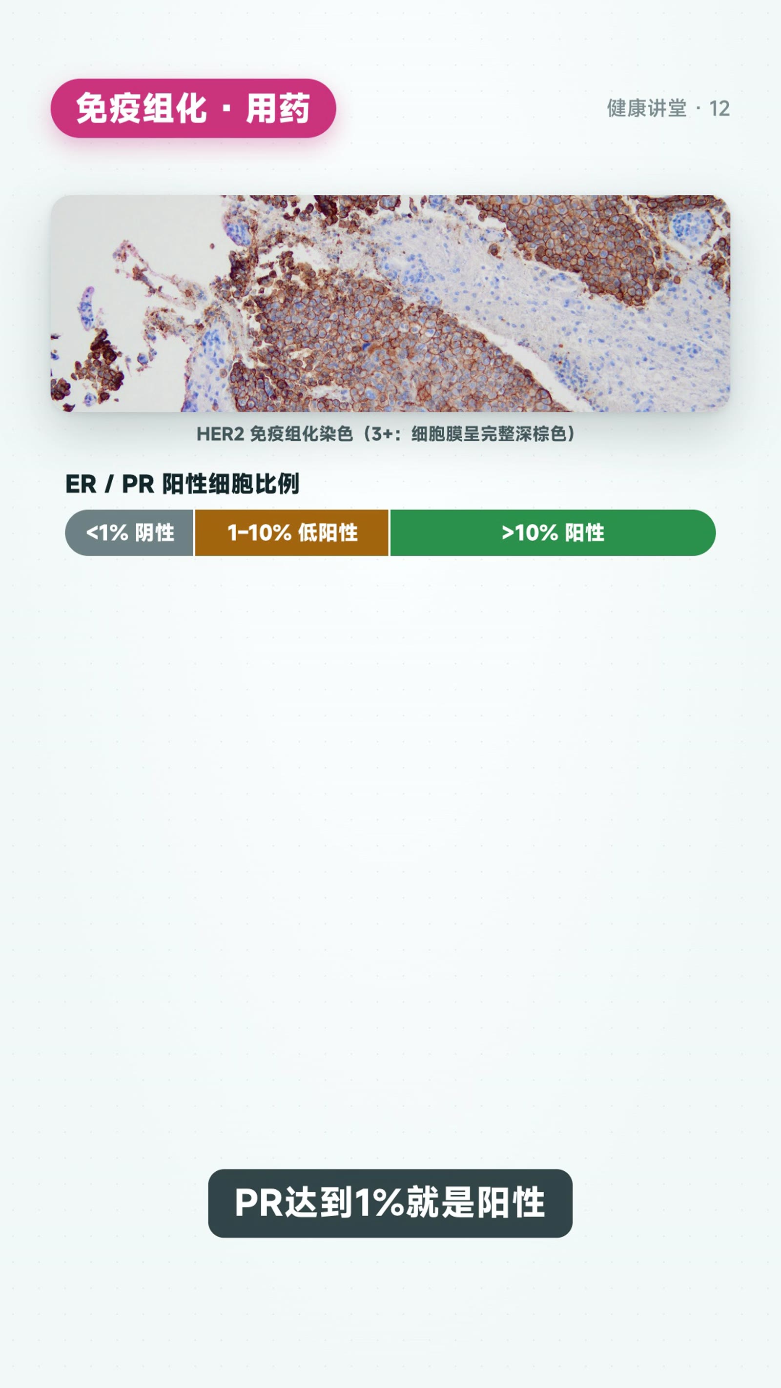 看懂病理报告:从「是什么癌」到「用什么药」