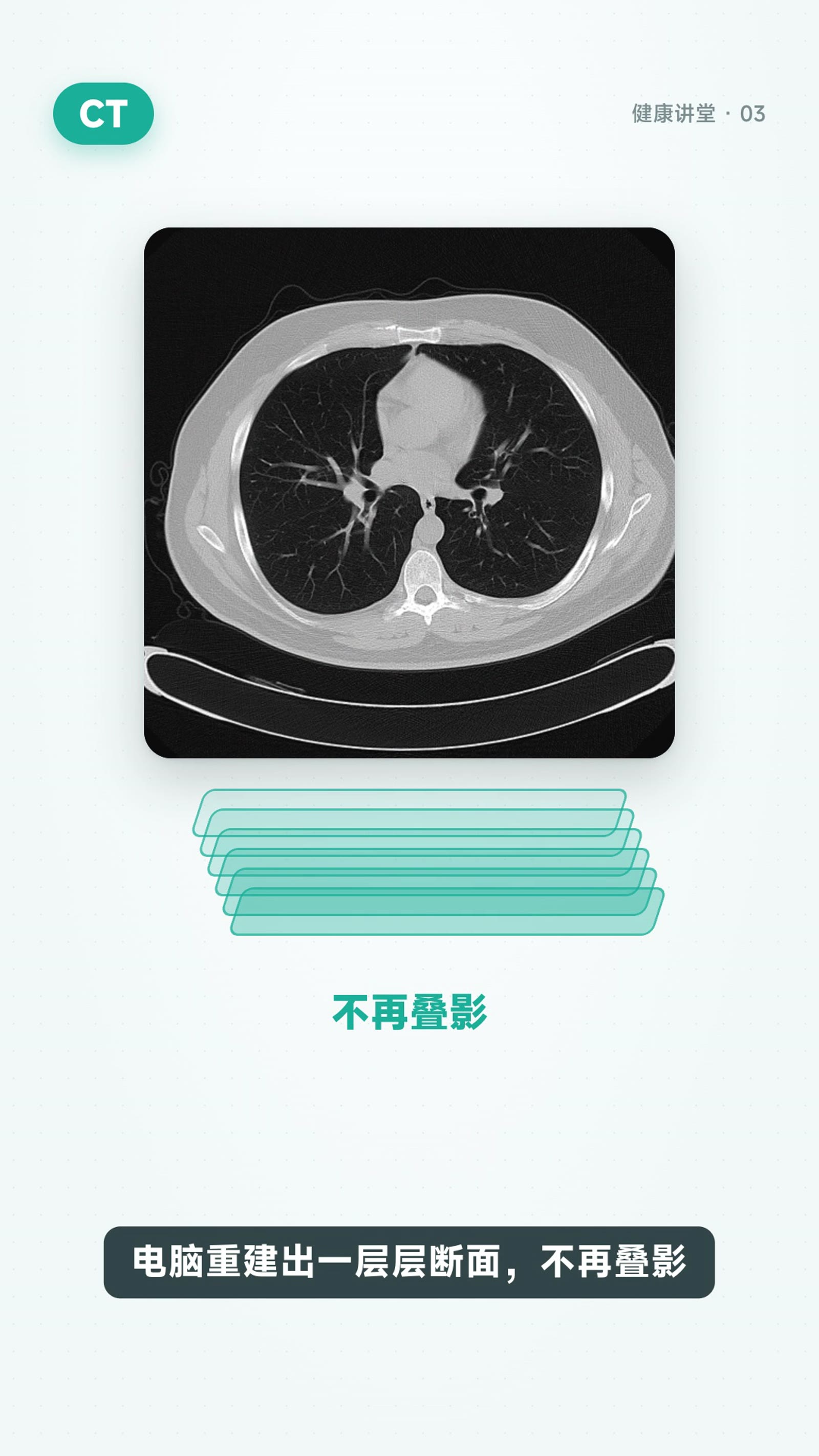 X光、CT、核磁:到底有什么区别